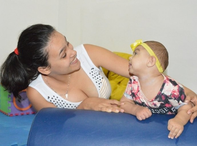 Sesau oferece atendimento humanizado a crianças com microcefalia