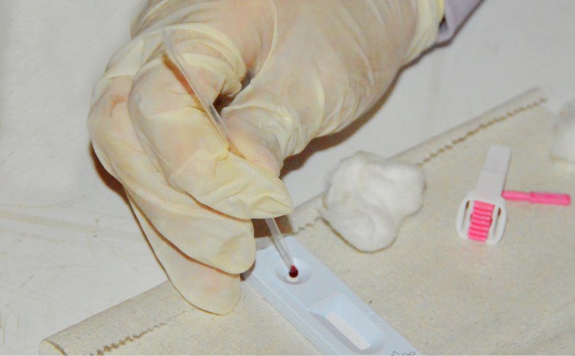 Sesau abre inscrições para o Curso sobre as Diretrizes de  Diagnóstico do HIV, Hepatites e Sífilis