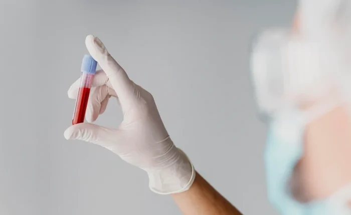 Atividade acontece de 8h da manhã até as 14 horas na  (URS) IB Gatto Falcão, no Tabuleiro do Martins