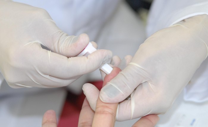Diagnóstico de hepatite ocorre nas Unidades Básicas de Saúde municipais, por meio do teste rápido