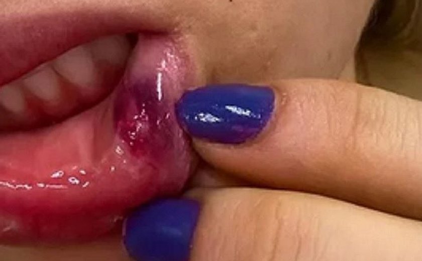 PC ﻿investiga piloto aviador denunciado por dar socos em mulher