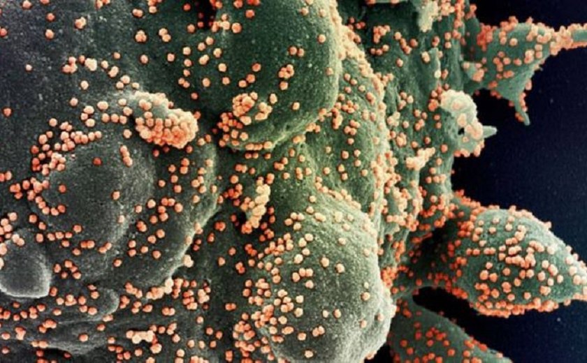 Ministério da Saúde quer recontar mortes por coronavírus
