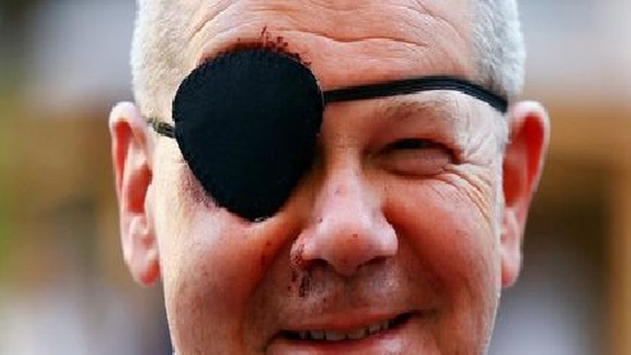 'Ansioso pelos memes', diz chanceler alemão ao postar foto de tapa olho após sofrer acidente