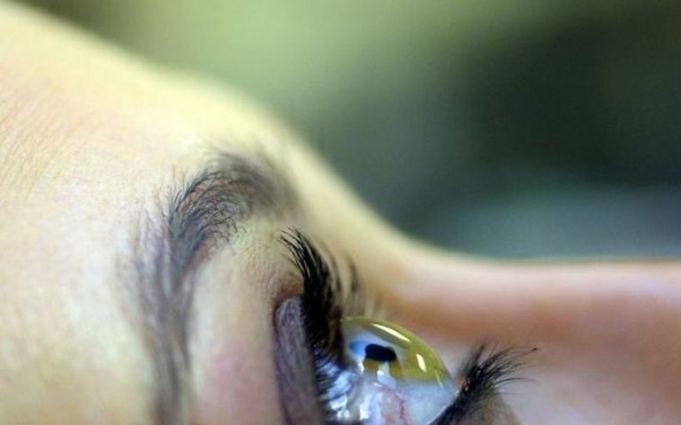 Lágrimas de sangue: saiba qual é a condição que fazia o Drácula da vida real chorar o líquido vermelho