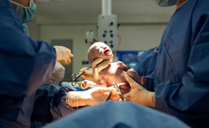 Dentre os leitos que serão disponibilizados, 35 serão criados em unidades estaduais e 27 no Hospital Veredas Dentre os leitos que serão disponibilizados, 35 serão criados em unidades estaduais e 27 no Hospital Veredas
