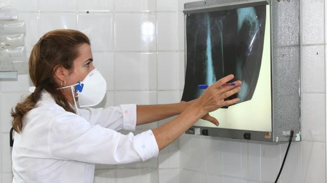 Exame para detectar tuberculose torna diagnóstico 100% mais rápido